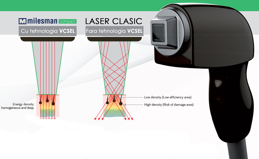 VCSEL comparatie alte lasere